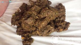 Young redhead shitting