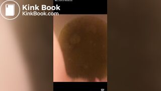 Bad day with watery diarrhea