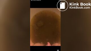 Bad day with watery diarrhea