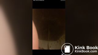 Bad day with watery diarrhea