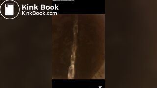 Bad day with watery diarrhea