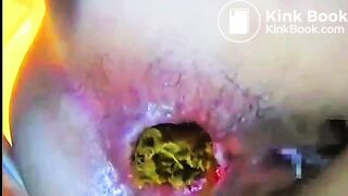 ASS CAMERA UP CLOSE ♥️♀️