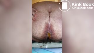 Is this IBS?