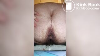 Is this IBS?