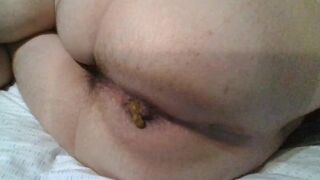 SHART ACCIDENT