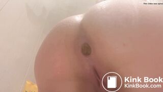 Me shitting 77