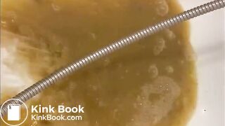 Girl walking in her diarrhea in socks