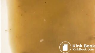 Girl walking in her diarrhea in socks