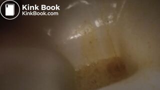 devastating liquid diarrhea