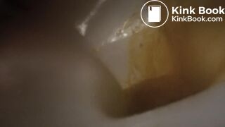 devastating liquid diarrhea