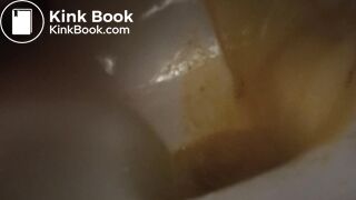 devastating liquid diarrhea
