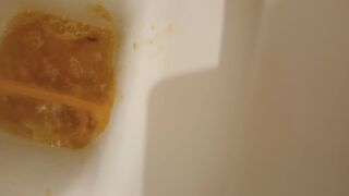 Total splatter of diarrhea!