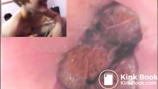 Check my poop