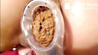 Girl Anal Speculum Shit