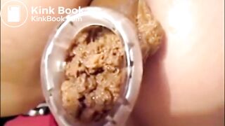 Girl Anal Speculum Shit