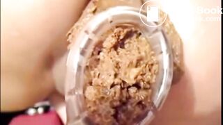 Girl Anal Speculum Shit