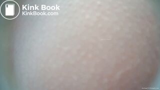 EXPLOSIVE DIARRHEA BIO TOILET