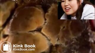 Rectal examination of a Japanese nurse