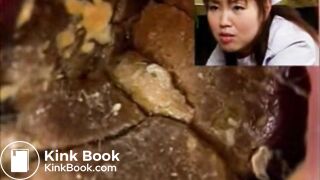 Rectal examination of a Japanese nurse