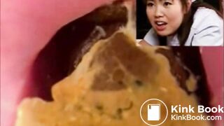 Rectal examination of a Japanese nurse