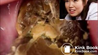 Rectal examination of a Japanese nurse