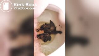 Unstoppable huge poop