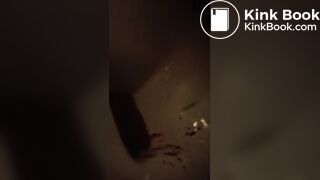 gurgling bowel and...