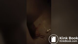 gurgling bowel and...