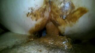 Grimy shitfuck with the flash on