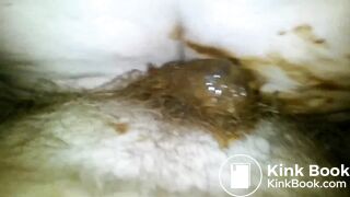 Grimy shitfuck with the flash on