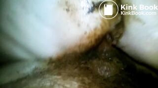 Grimy shitfuck with the flash on