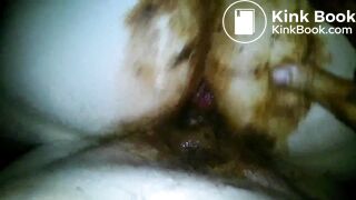 Grimy shitfuck with the flash on