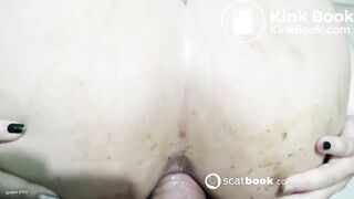 elastic ass shit fisting 8