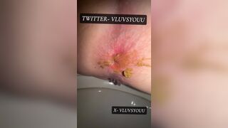 White Teen Shows Her Asshole