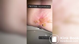 White Teen Shows Her Asshole