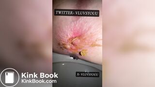 White Teen Shows Her Asshole