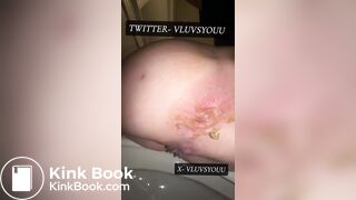 White Teen Shows Her Asshole