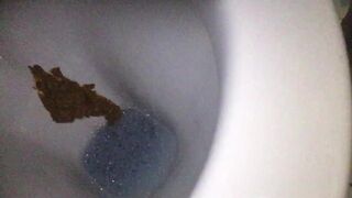 Creamy shit in toilet