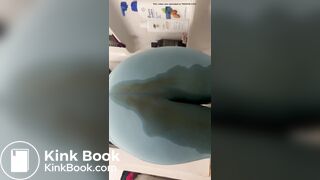 Unsuspecting Laxative Accident