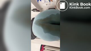 Unsuspecting Laxative Accident