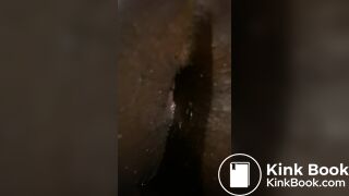After anal