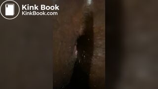 After anal