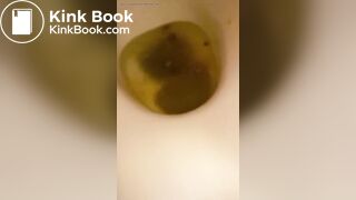 girl diarrhea and fart - video 2