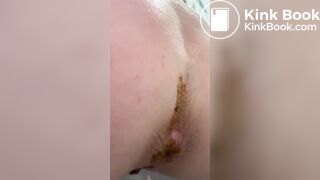 Shit on toilet - video 5