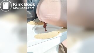 The girl squatted on the toilet to defecate