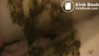 Santa Helper Thong Diarrhea