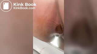 explosive diarrhea close up view