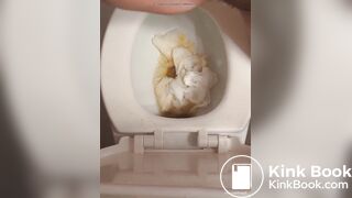 emergency shit from big hairy ass with enema