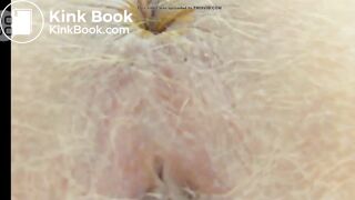 Blond Anus Hair Close Up Pooping Compilation
