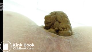 Blond Anus Hair Close Up Pooping Compilation